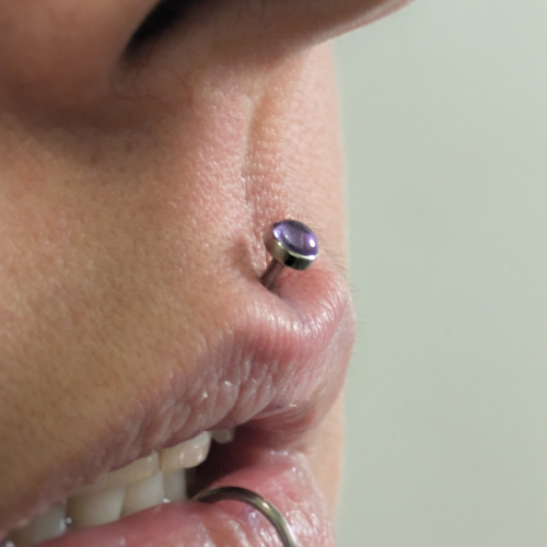 philtrum